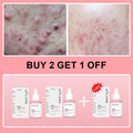 Collagen Peptide Facial Serum Targets Dull Skin Boosts Skin Elasticity Stimulates Skin Renewal Repair Salmon PDRN KOREAN Product