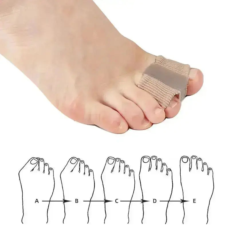 Silicone Toe Separators for Bunions | Pain Relief Toe Spacers